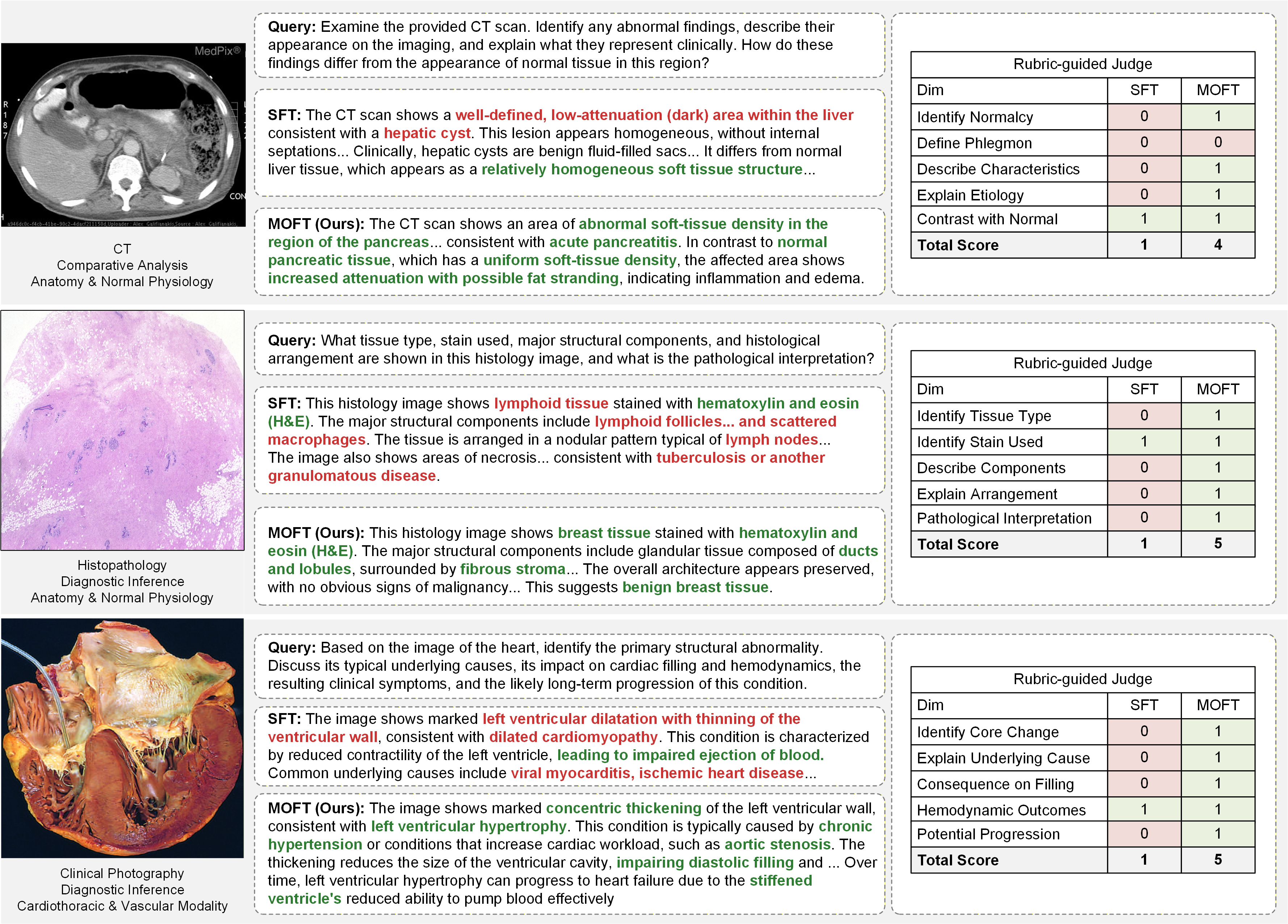 Qualitative examples of standard SFT and the proposed MOFT